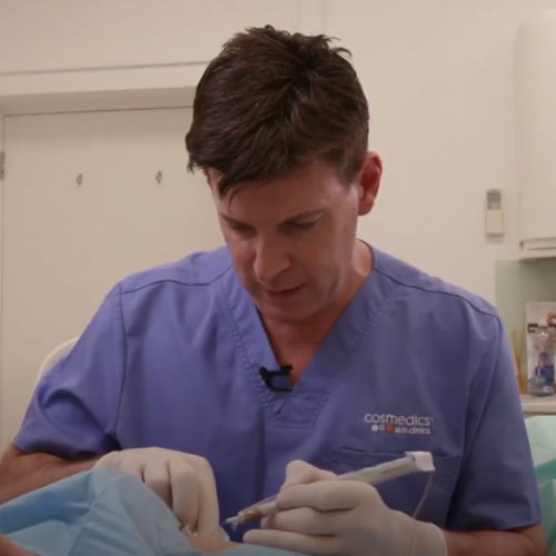 Foot mole removal surgery